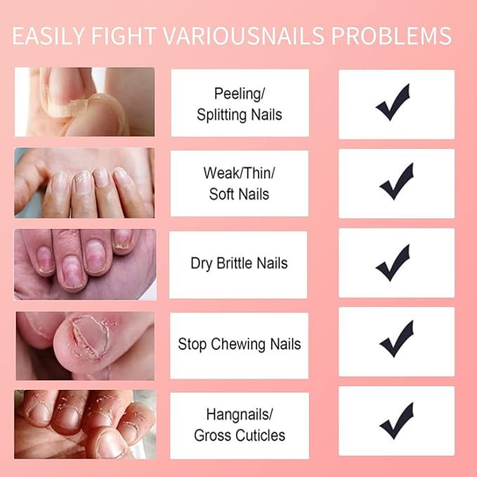 NBC - Hands & Feet Cuticle Oil 15ml (Many Scents)